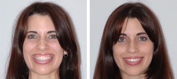 Dentist in West Chester