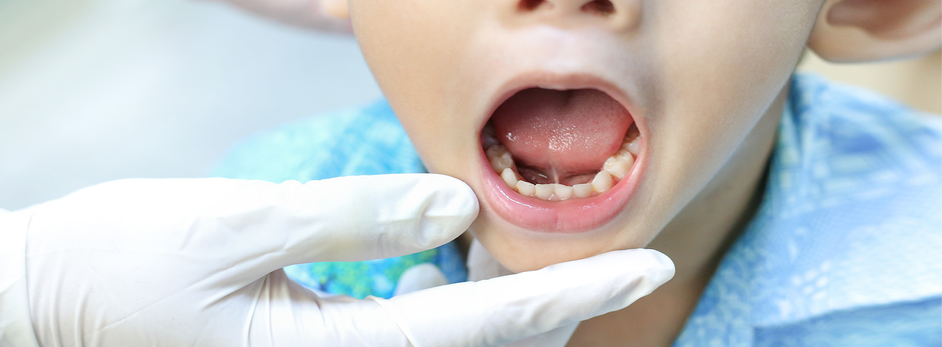 Tongue Tie Dentist 19382